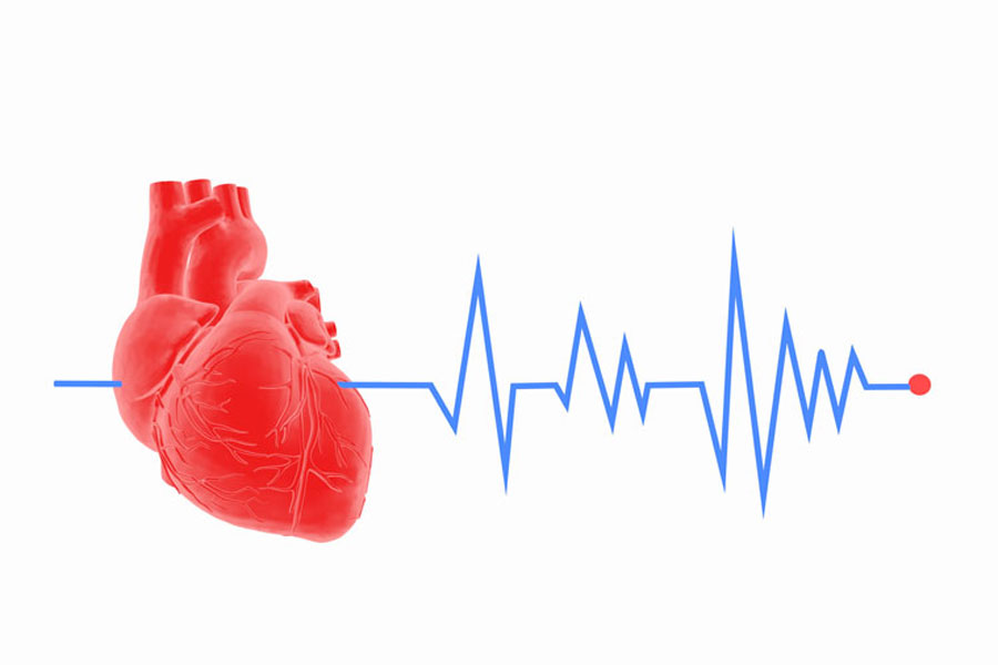 Cardiac Arrhythmia Management - Phoenix Cardiovascular Institute